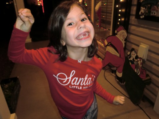 All I want for Christmas are my two front teeth